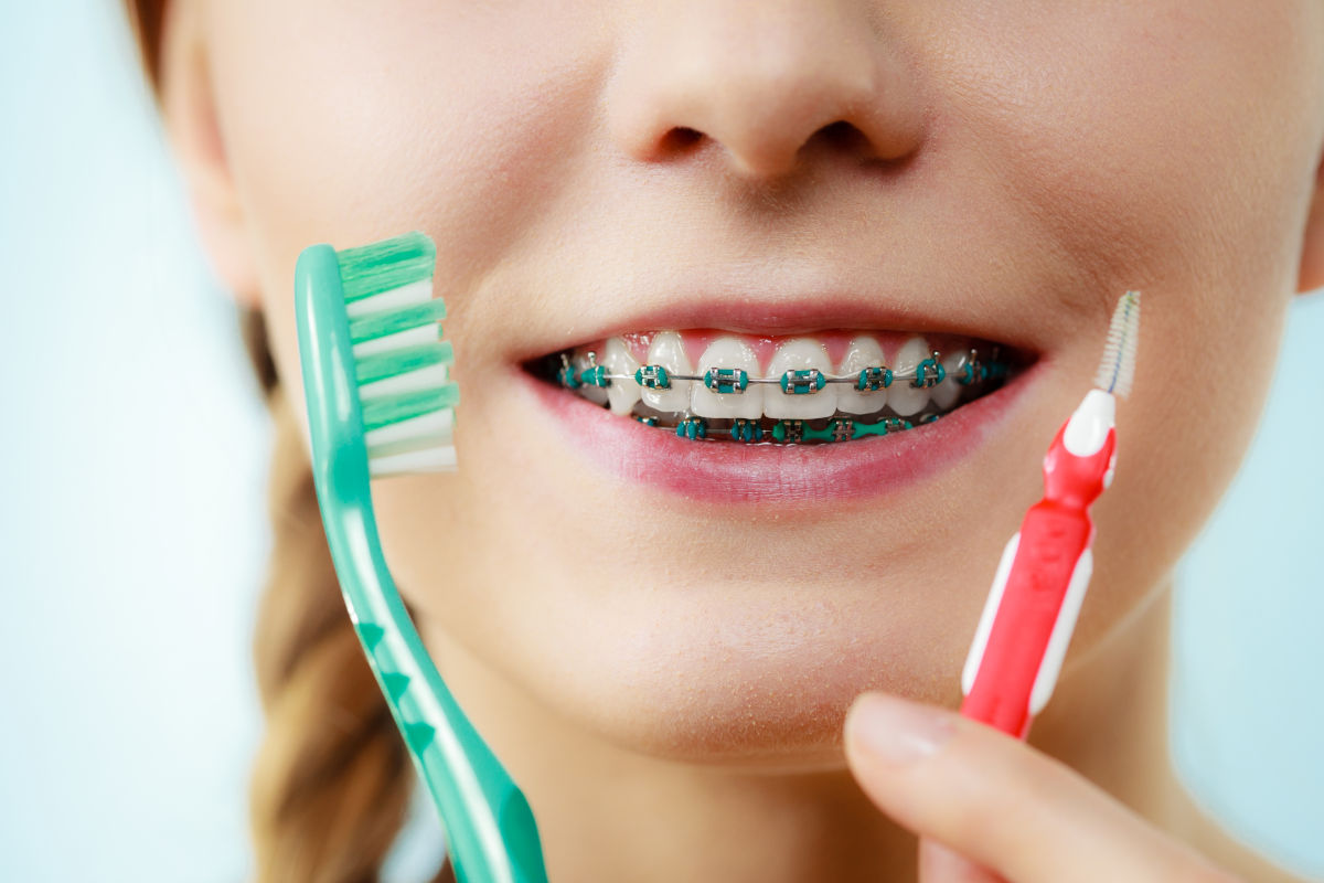 How to Properly Brush Your Teeth with Braces?