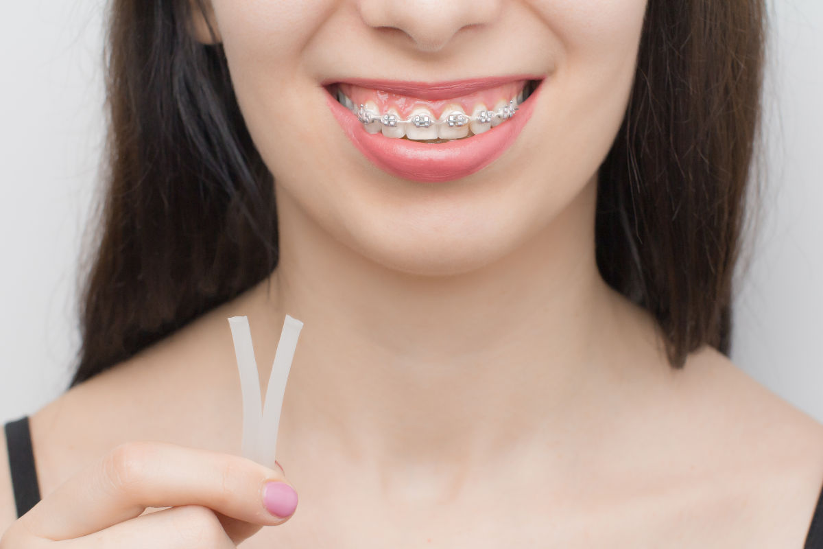 Orthodontic Wax: How to Use It Properly for Pain Relief?