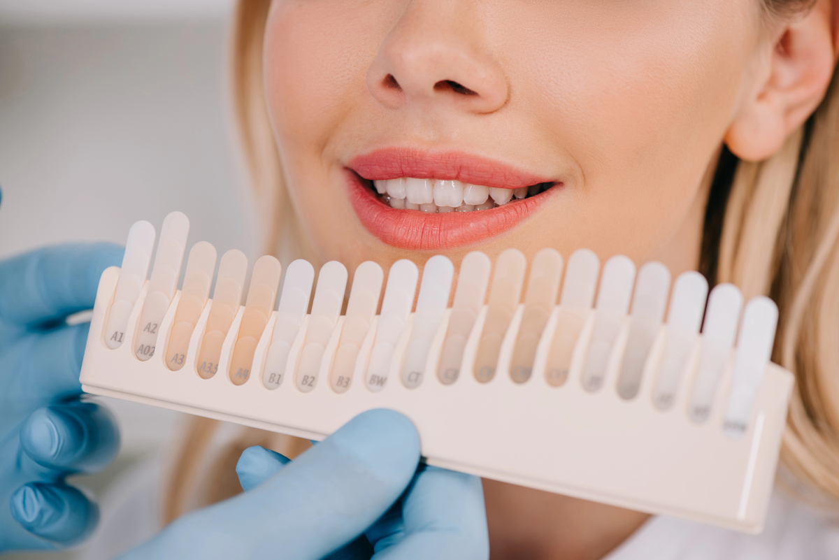 Teeth Whitening: Price, Reimbursement, and Risks