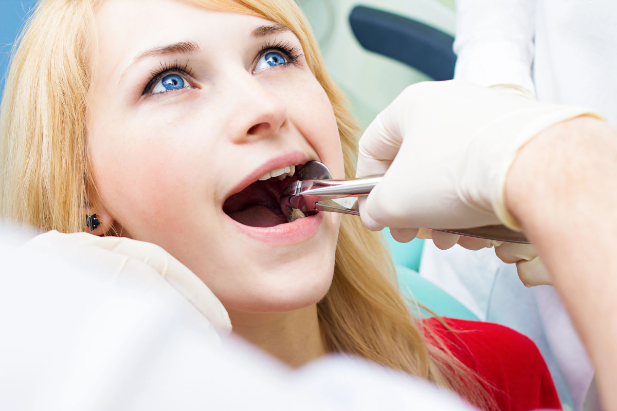 Dental Extraction: Everything to Know About Having a Tooth Pulled